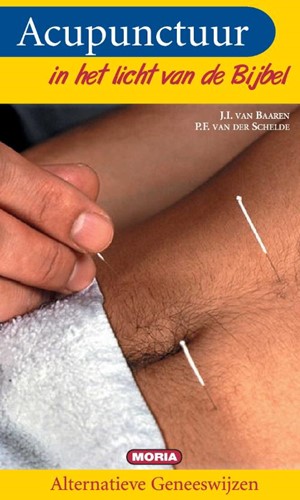 Acupunctuur (Paperback)